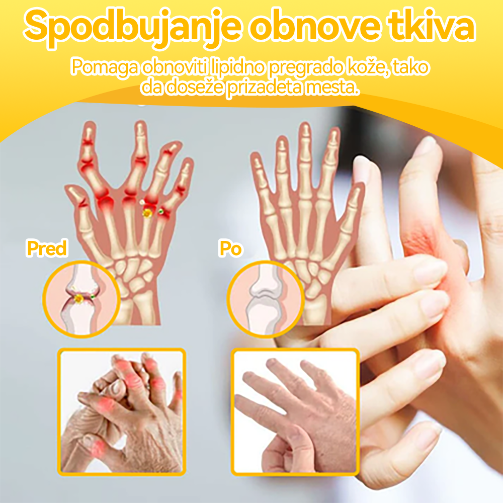 ✅ Uradna trgovina: 𝐒𝐩𝐳𝐯®📦 Č𝐞𝐛𝐞𝐥𝐣𝐢 𝐒𝐭𝐫𝐮𝐩 𝐒𝐤𝐥𝐞𝐩𝐢 & 𝐊𝐨𝐬𝐭𝐢 𝐙𝐝𝐫𝐚𝐯𝐥𝐣𝐞𝐧𝐣𝐞 𝐊𝐫𝐞𝐦𝐚 🐝 (𝐙𝐧𝐚č𝐚𝐣𝐧𝐨 za 𝐨𝐫𝐭𝐨𝐩𝐞𝐝𝐬𝐤𝐞 𝐛𝐨𝐥𝐞𝐳𝐧𝐢 𝐢 𝐛𝐨𝐥𝐞č𝐢𝐧𝐞 𝐩𝐫𝐢 𝐚𝐫𝐭𝐫𝐢𝐭𝐢𝐬𝐮)