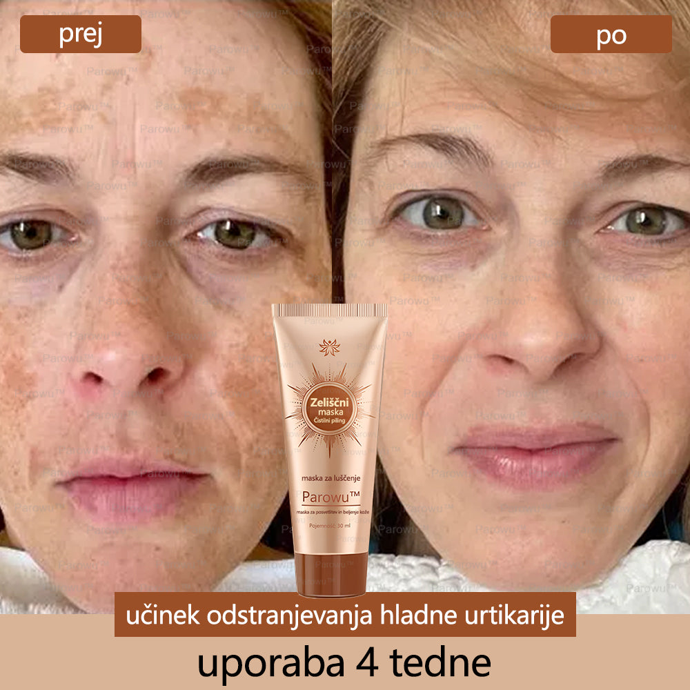Parowu™ Belilna in Odstranjevalna Maska za madeže - 🍀 Naravne sestavine trajno odstranjujejo pigmentne madeže, starostne pege, pegice in sončne madeže 🔥