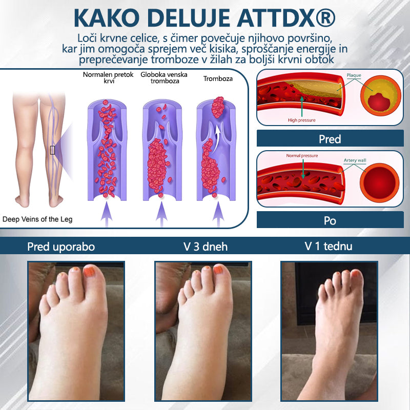 ATTDX® Črni kumen – zeliščna krema za pomiritev oteklin 🌿🦵