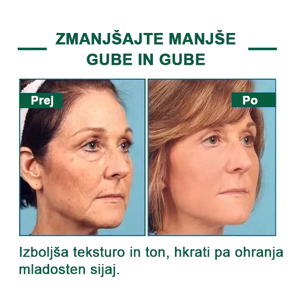 🌿Osvežite kožo v samo treh dneh💝𝙁𝙪𝙗𝙨𝙩𝙖™ pomlajevalni in učvrstitveni serum🔥