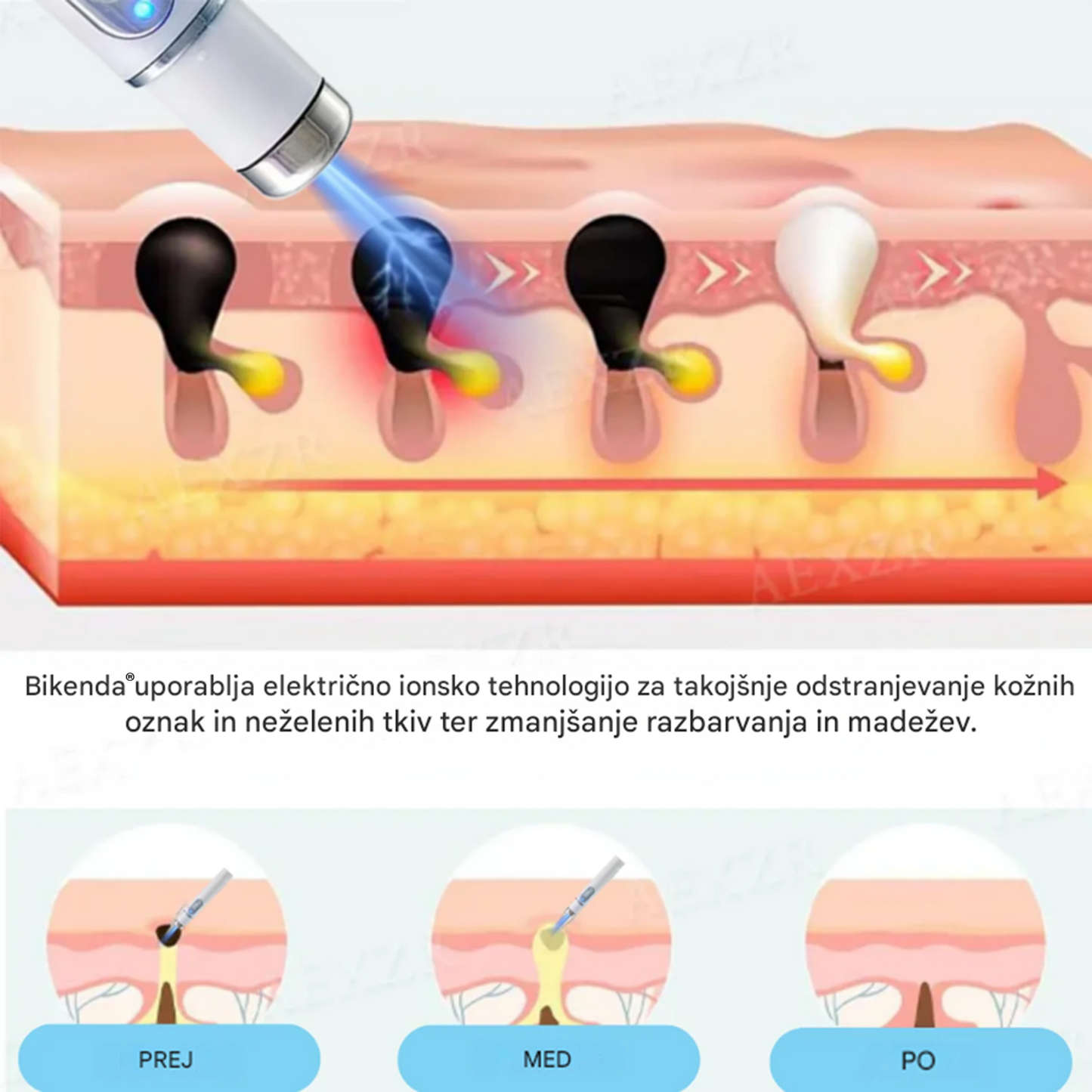 Bikenda® neinvazivno lasersko pero za odstranjevanje madežev in bradavic