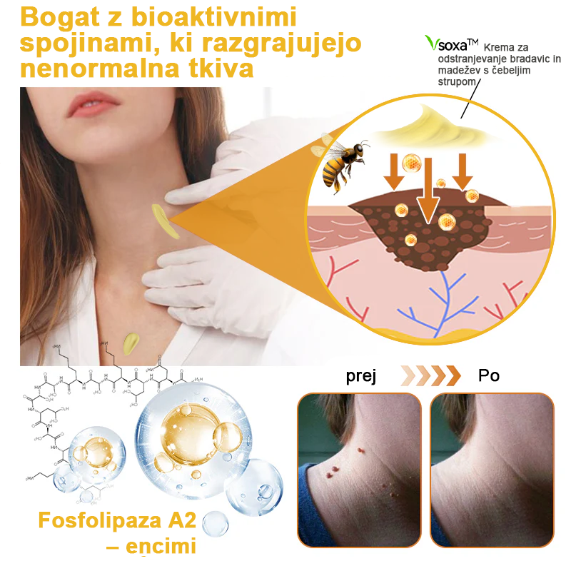 ✨🎁𝑭𝑹𝑶𝑷𝑼𝑵™ krema za odstranjevanje znamenj in madežev (85% popust zadnji dan dogodka)