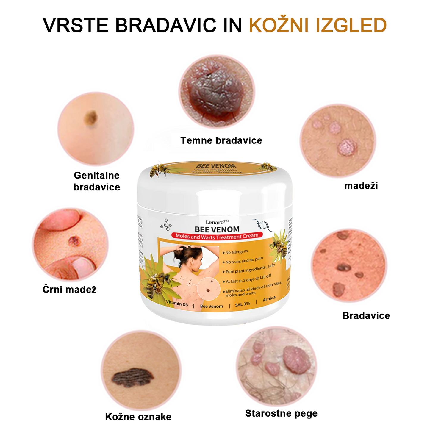 🐝 Krema Lenaro™ za zdravljenje madežev in bradavic 💎💎💎Primerna za vse starostne kategorije🐝
