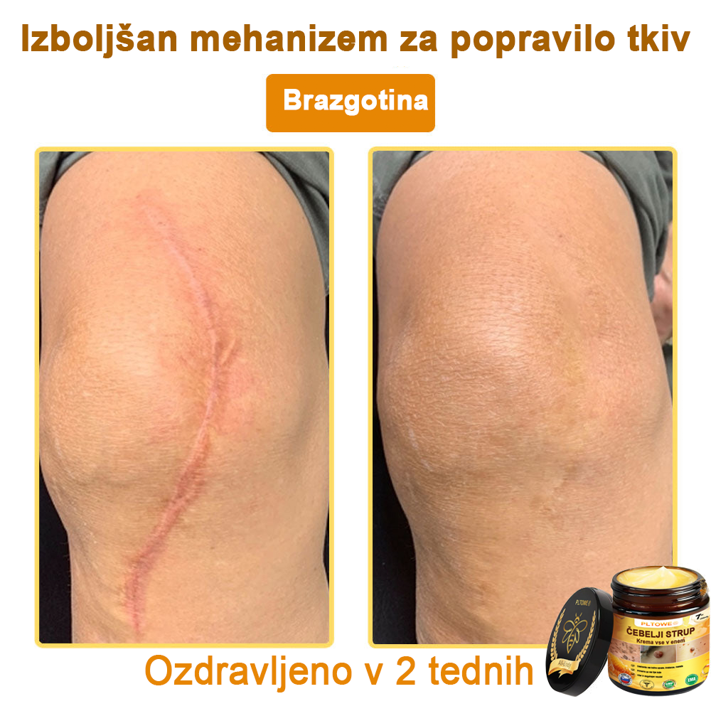 ZADNJA PRILOŽNOST! Zgrabi to srečno najdbo s 70 % Popustom! 🔥180-DNEVNO GARANCIJA VRAČILA DENARJA!