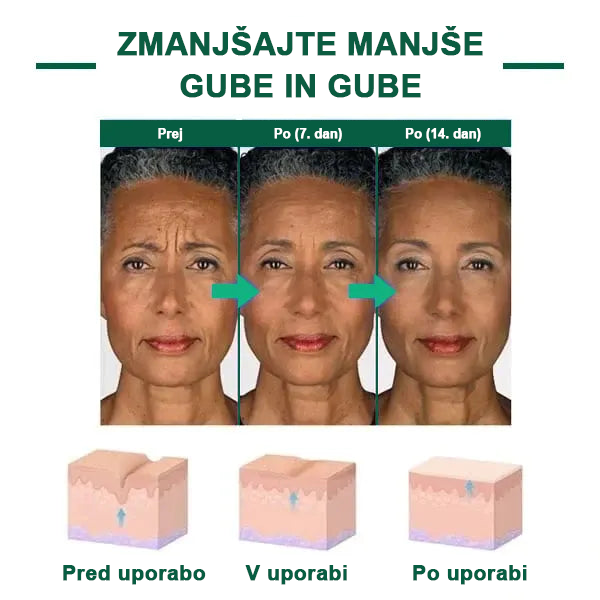 🌿Osvežite kožo v samo treh dneh💝𝙁𝙪𝙗𝙨𝙩𝙖™ pomlajevalni in učvrstitveni serum🔥