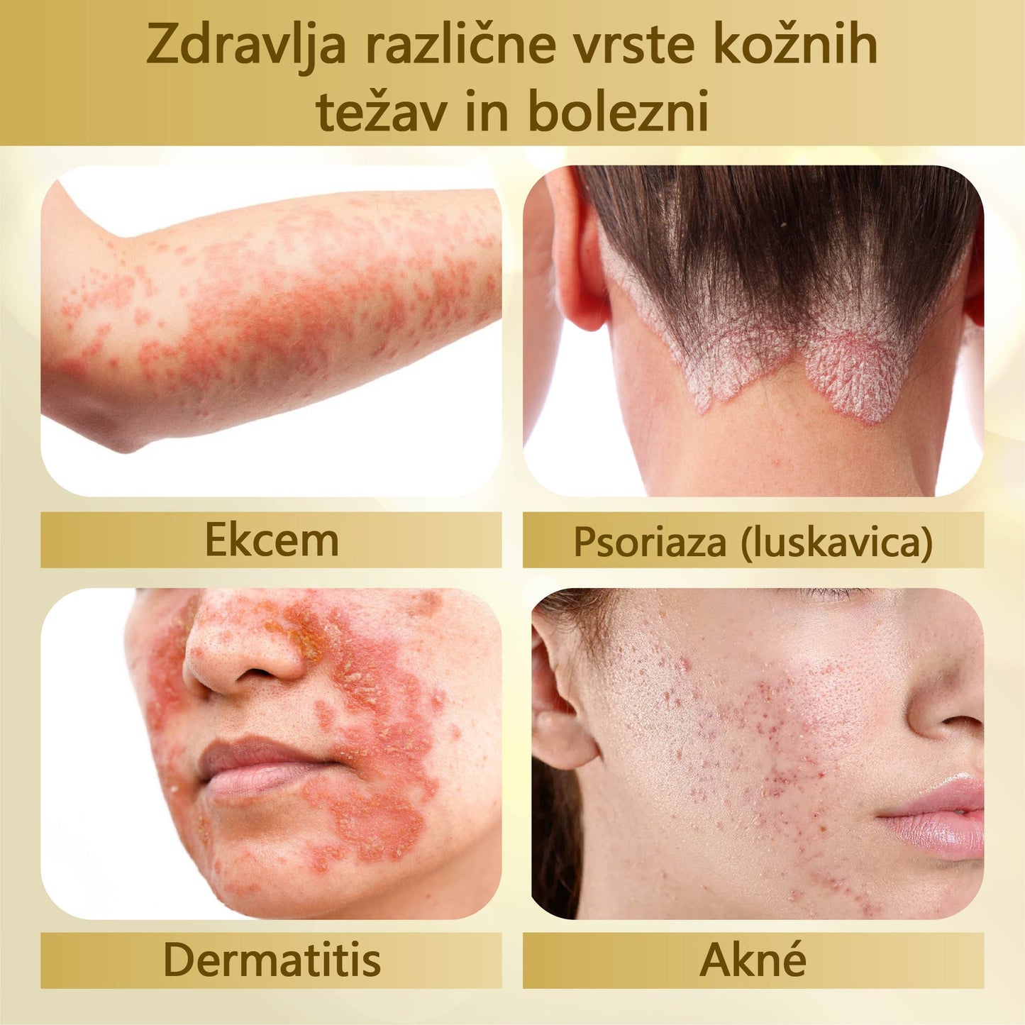 🌟 TOPWAL® Condense Krema za obnovo kože z čebeljim strupom 🌿 Spodbuja regeneracijo kože 💧 Globoko vlaži in neguje ✨ Zmanjšuje drobne gube in linije 🐝 Obogatena z naravnim čebeljim strupom ✔️ Primerna za vse tipe kože, tudi občutljivo