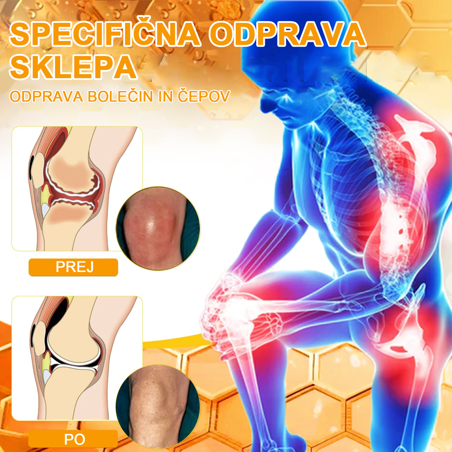 🔥 𝘈𝘦𝘵𝘩𝘦𝘳𝘪𝘴™ Krema za lajšanje artritisa s čebeljim strupom (posebej za starejše odrasle) 🦴– zadnji dan promocije: 70 % popusta 💪