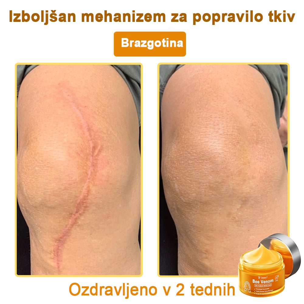Daasry® Cebelji Strup Kožna Terapija Serum Krema👨⚕️ (Primerno za vse starosti & priporočeno s strani EMA)