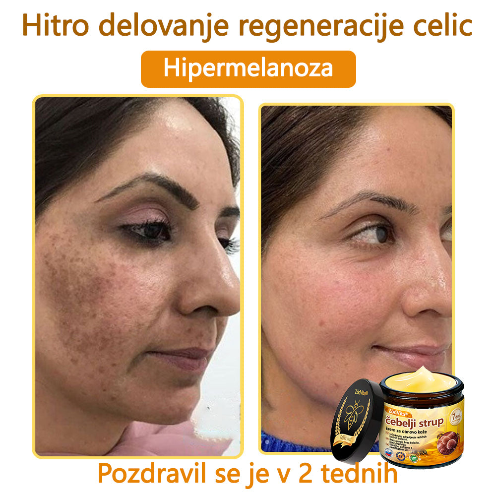 💟 Dermatologi priporočajo ✨ ZödVita® obnavljajoča krema z čebeljim strupom 🔥  CE-certifikat in ga priporoča Slovensko dermatološko društvo (SDD)