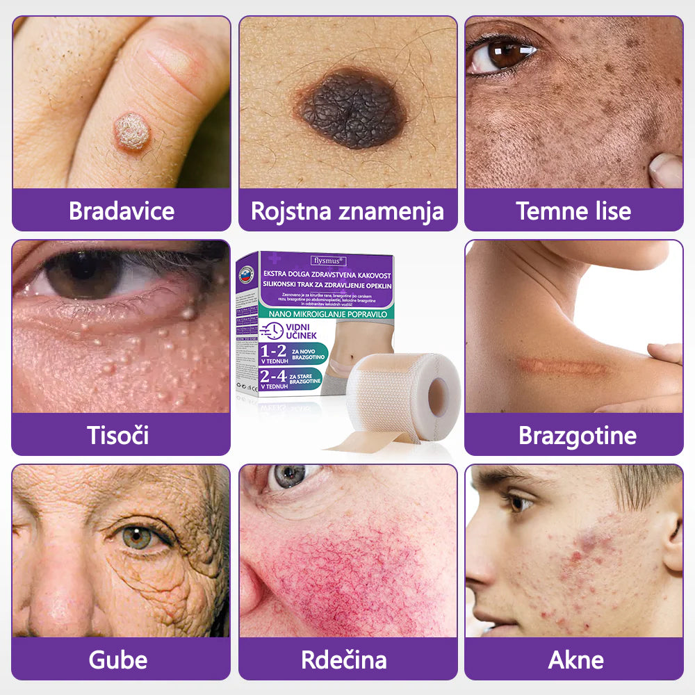🏷️ Uradna Trgovina: flysmus® ReGen Mikronadlaste Ploščice z Nano-Hialuronsko Kislino (Nano-Heal) 💝 Zdravljenje novih in starih brazgotin, zmanjševanje kirurških brazgotin, strij, keloidov, aken, opeklin, bradavic, dermatomov in krčnih žil