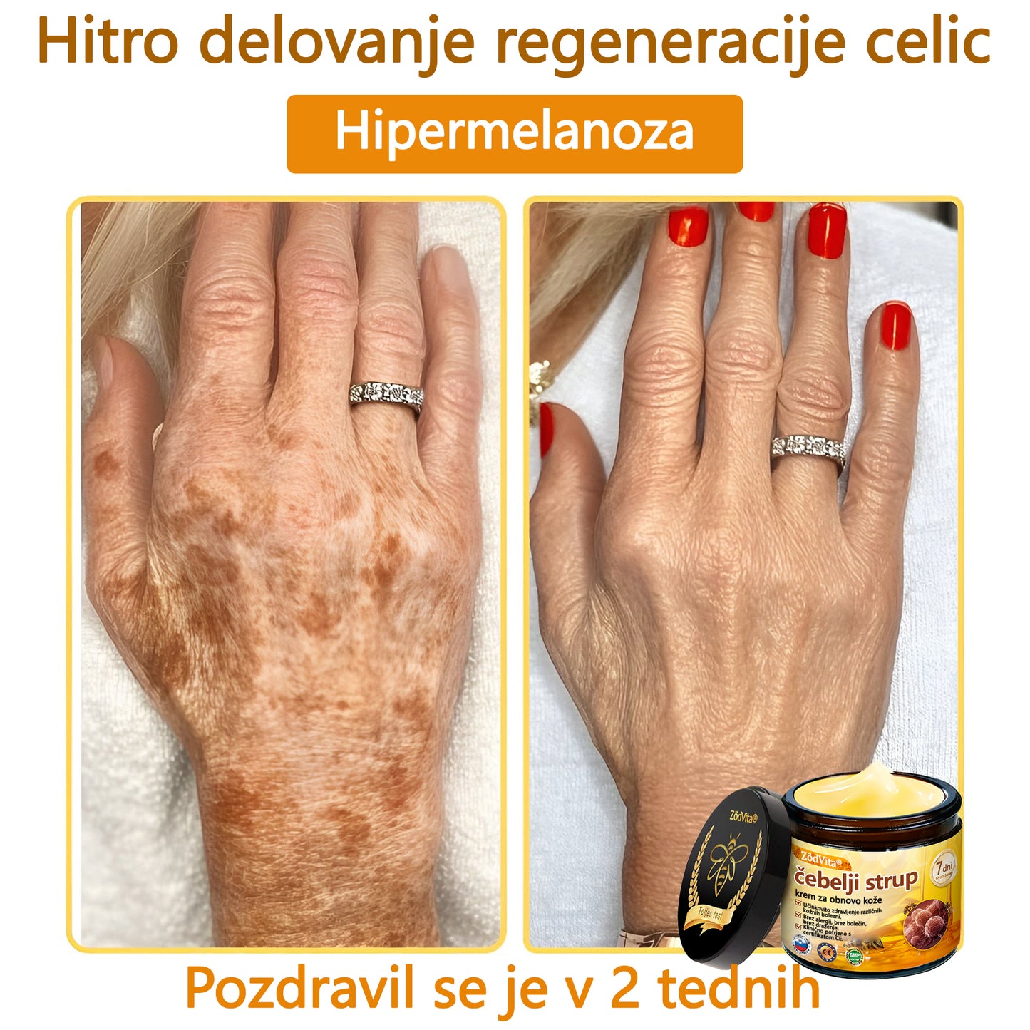 💟 Dermatologi priporočajo ✨ ZödVita® obnavljajoča krema z čebeljim strupom 🔥  CE-certifikat in ga priporoča Slovensko dermatološko društvo (SDD)