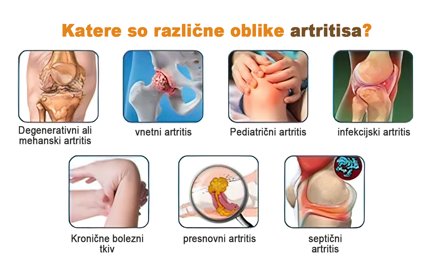 🏆🌈𝐙𝐨𝐞𝐧𝐜𝐠𝐳™ krema za zdravljenje artritisa in krčnih žil s čebeljim strupom✨