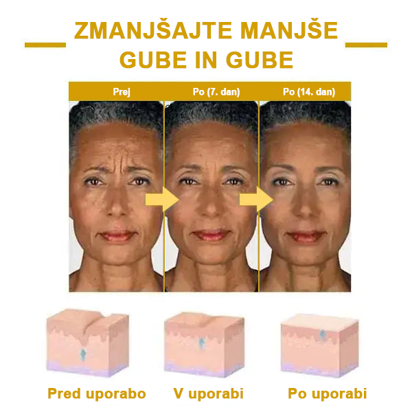 🌿𝐅𝐮𝐛𝐬𝐭𝐚® pomlajevalno olje za učvrstitev kože🩵 Zadnji dan popusta: 75 % CENEJE💧