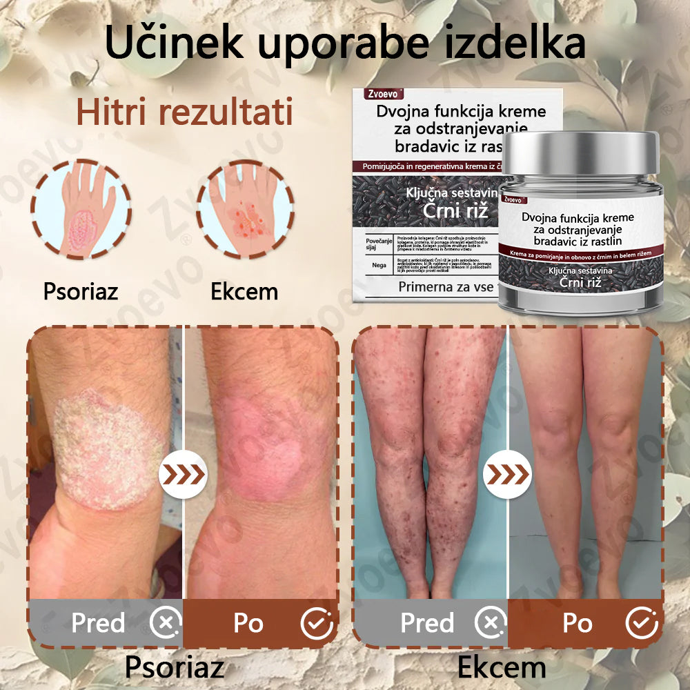 Zvoevo® Black Rice Skin Repair Essence Cream ⚕️ Certificirano pri EU (Odstranjuje bradavice in kožne izrastke, lajša luskavico, izboljšuje kopičenje keratina in folikularno keratinizacijo, posvetli pigmentacijo, sončne pege in starostne pege)