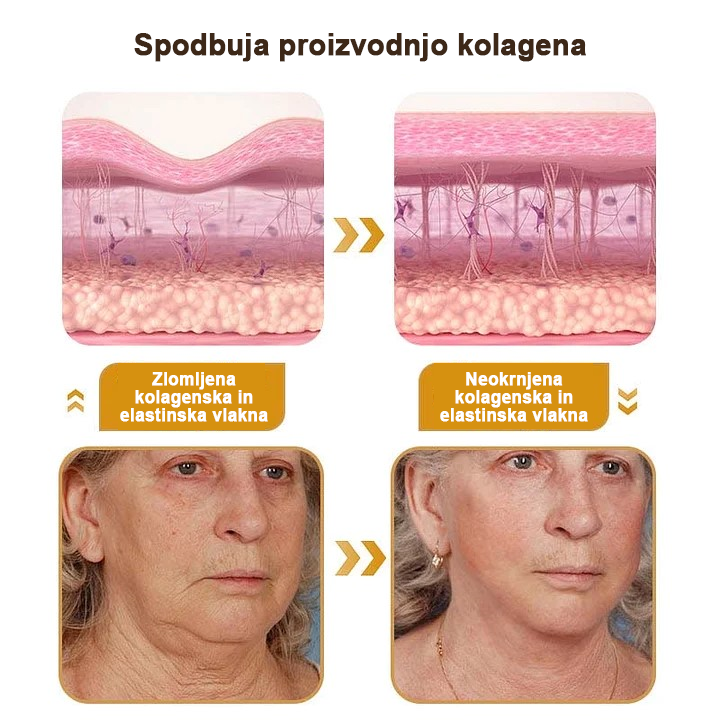 🍀 Zadnji dan promocije: 83 % popust ✨𝐅𝐮𝐫𝐳𝐞𝐫𝐨™ Kremni odstranjevalec gub z čebeljim strupom in botoks učinkom🐝
