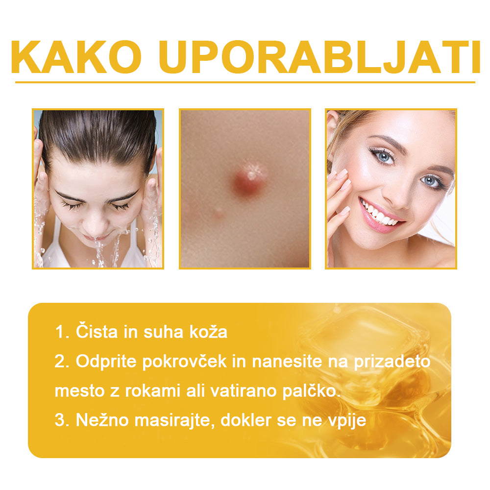 ✨🎁𝑭𝑹𝑶𝑷𝑼𝑵™ krema za odstranjevanje znamenj in madežev (85% popust zadnji dan dogodka)