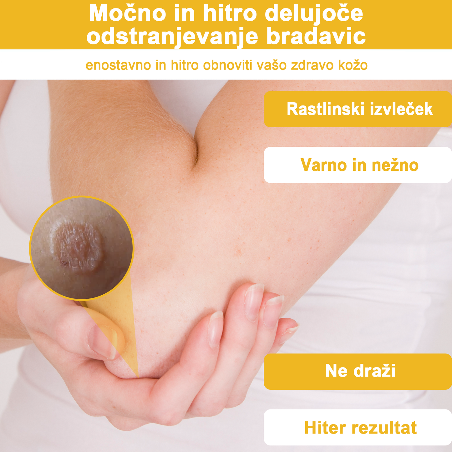 ✨🎁𝑭𝑹𝑶𝑷𝑼𝑵™ krema za odstranjevanje znamenj in madežev (85% popust zadnji dan dogodka)
