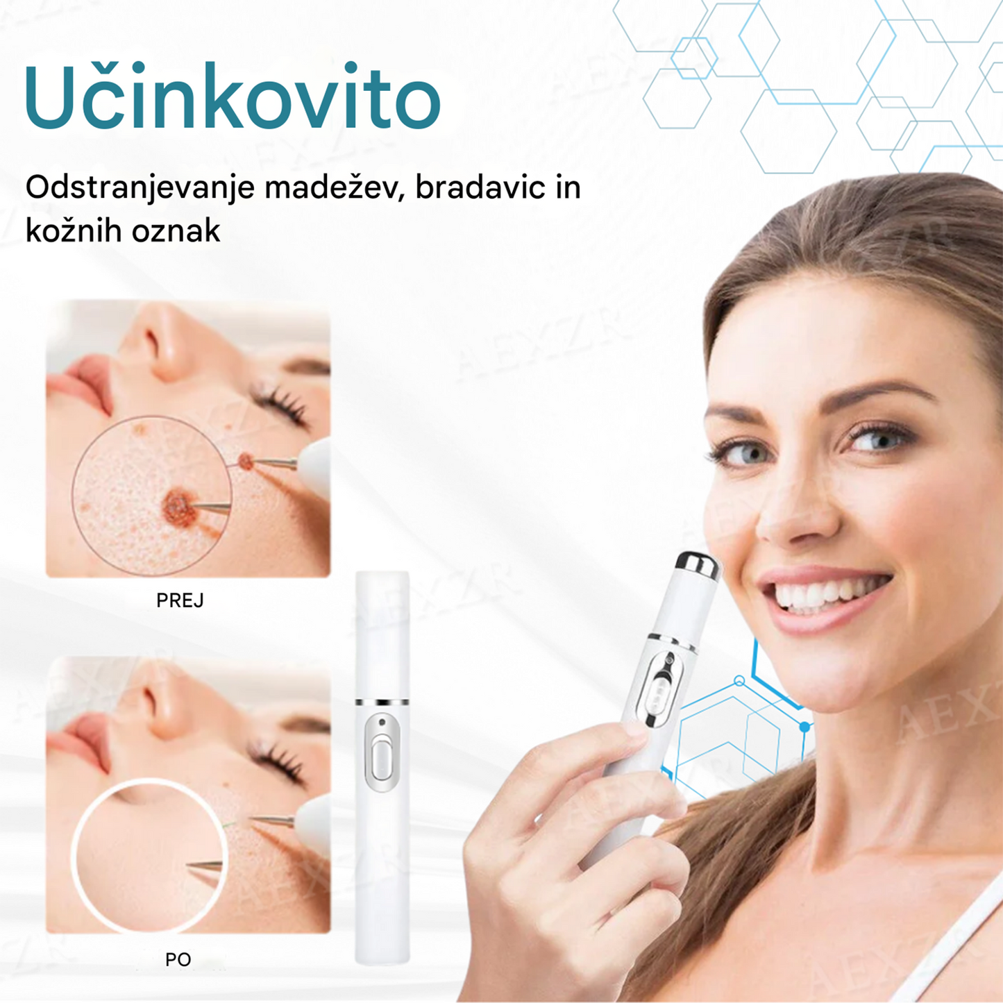 Bikenda® neinvazivno lasersko pero za odstranjevanje madežev in bradavic