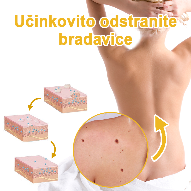 ✨🎁𝑭𝑹𝑶𝑷𝑼𝑵™ krema za odstranjevanje znamenj in madežev (85% popust zadnji dan dogodka)