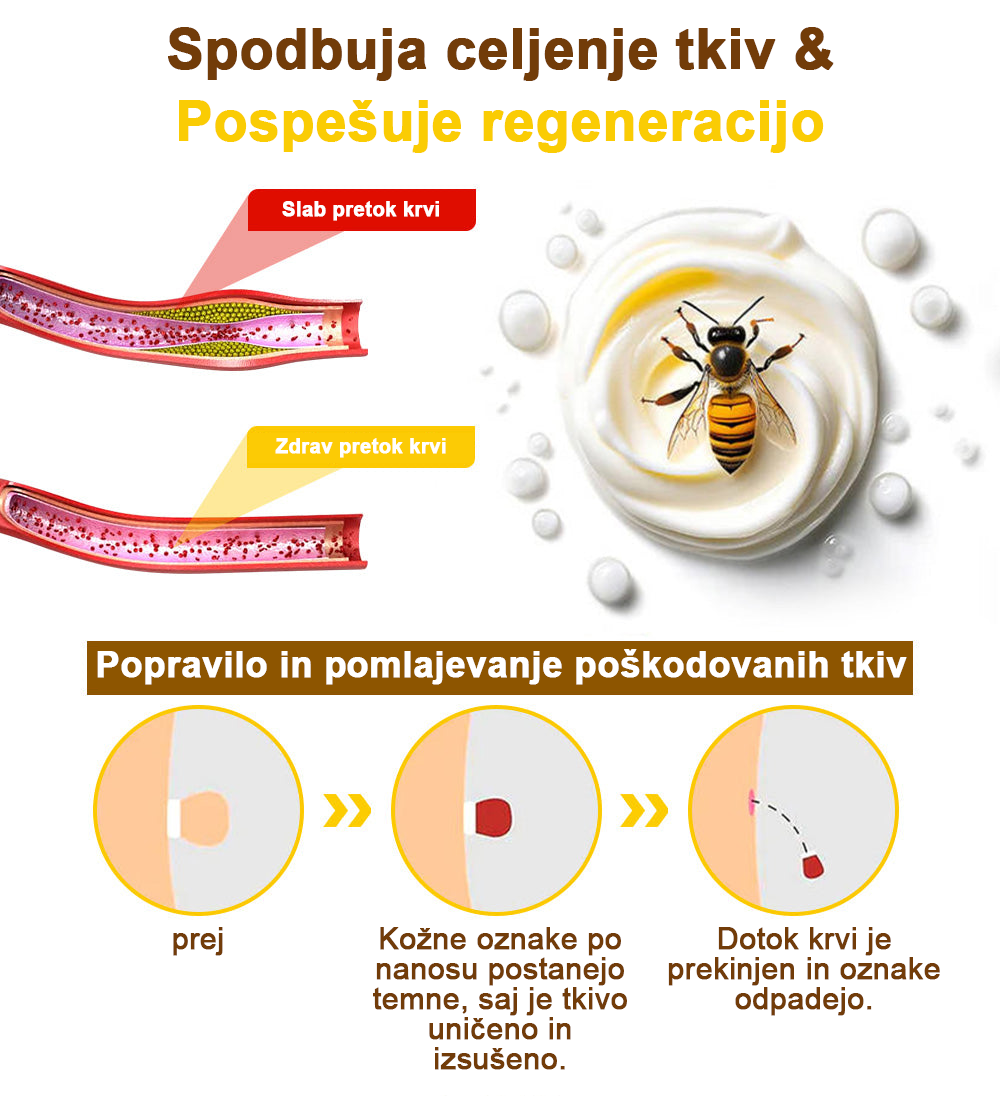 ✅flysmus™ zdravilna krema s čebeljim strupom🐝: Zdravljenje ekcemov, luskavice, aken, rozacee, glivičnih okužb, bradavic