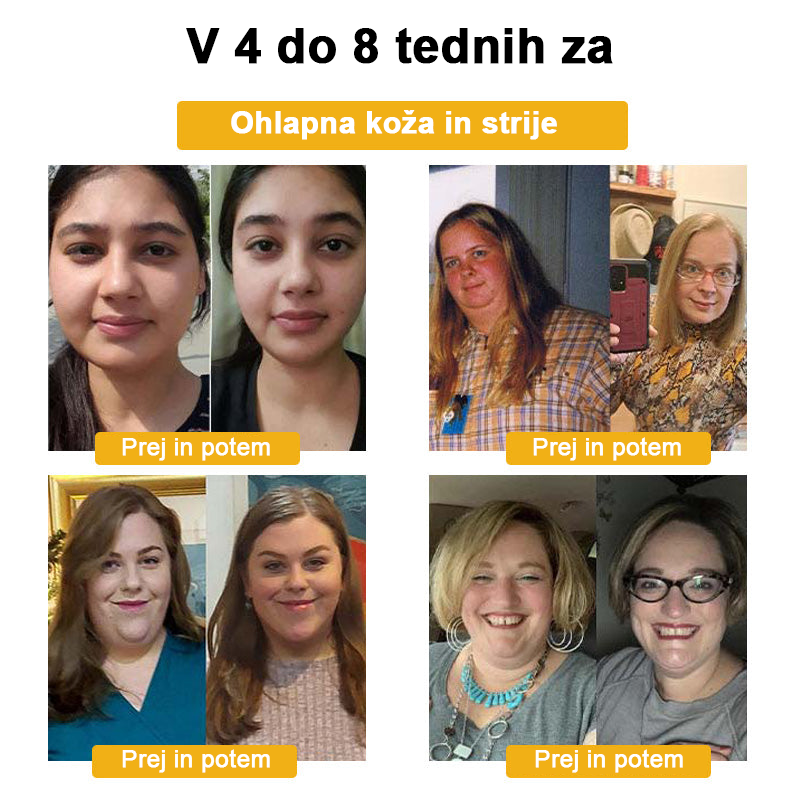🍀🎈𝐅𝐑𝐎𝐏𝐔𝐍™ Čebelji strup Limfna drenaža obliž za hujšanje (Za vse limfatične težave in debelost)