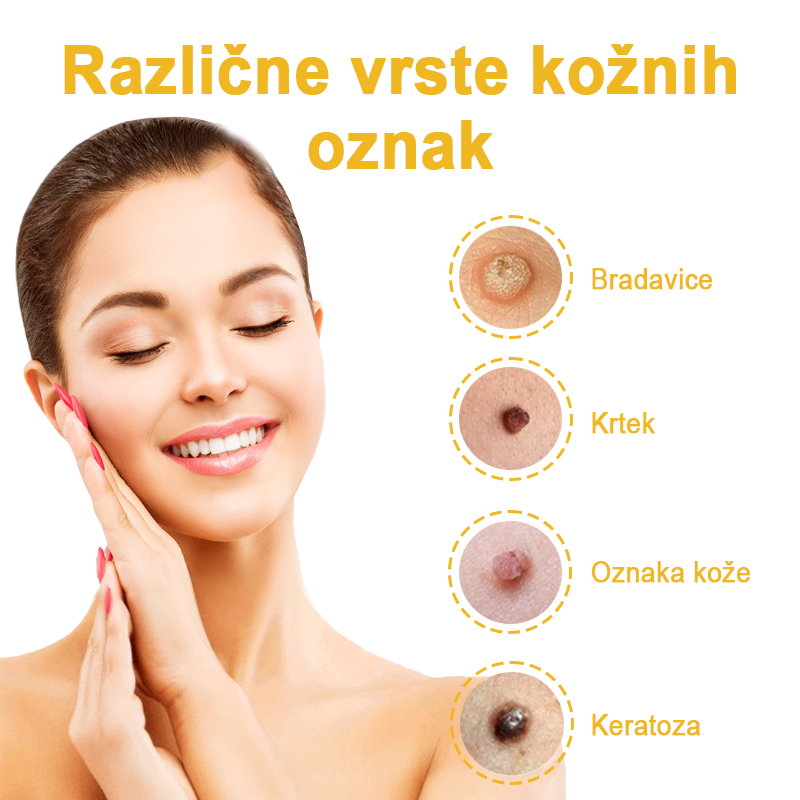 ✨🎁𝑭𝑹𝑶𝑷𝑼𝑵™ krema za odstranjevanje znamenj in madežev (85% popust zadnji dan dogodka)