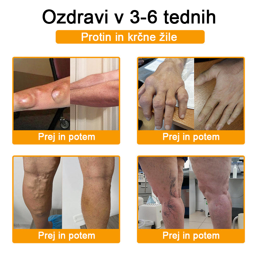 ADNOON™ Krema za lajšanje bolečin in celjenje kosti z botulin toksinom in čebeljim strupom
