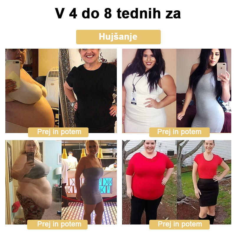 🍀🎈𝐅𝐑𝐎𝐏𝐔𝐍™ Čebelji strup Limfna drenaža obliž za hujšanje (Za vse limfatične težave in debelost)