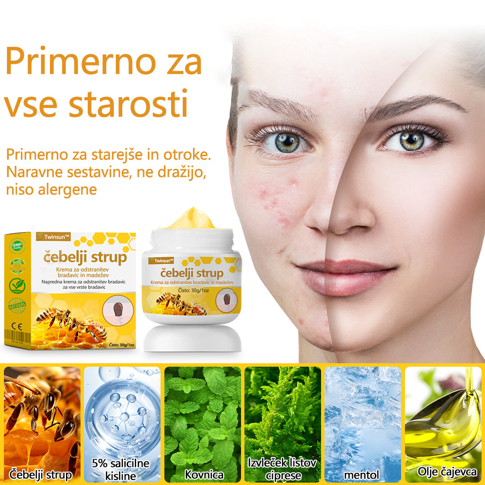 🐝Twinsun™ Izjemno Močna Krema z Čebeljim Strupom, s certifikatom EMA💖 Za zdravljenje bradavic, kožnih izrastkov, okužb in keratoze, ter za glajenje neenakomerne kože
