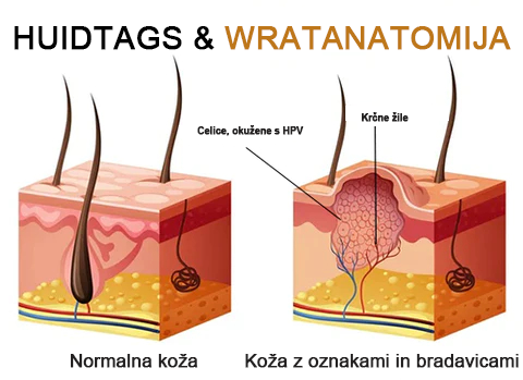🐝 Krema Lenaro™ za zdravljenje madežev in bradavic 💎💎💎Primerna za vse starostne kategorije🐝