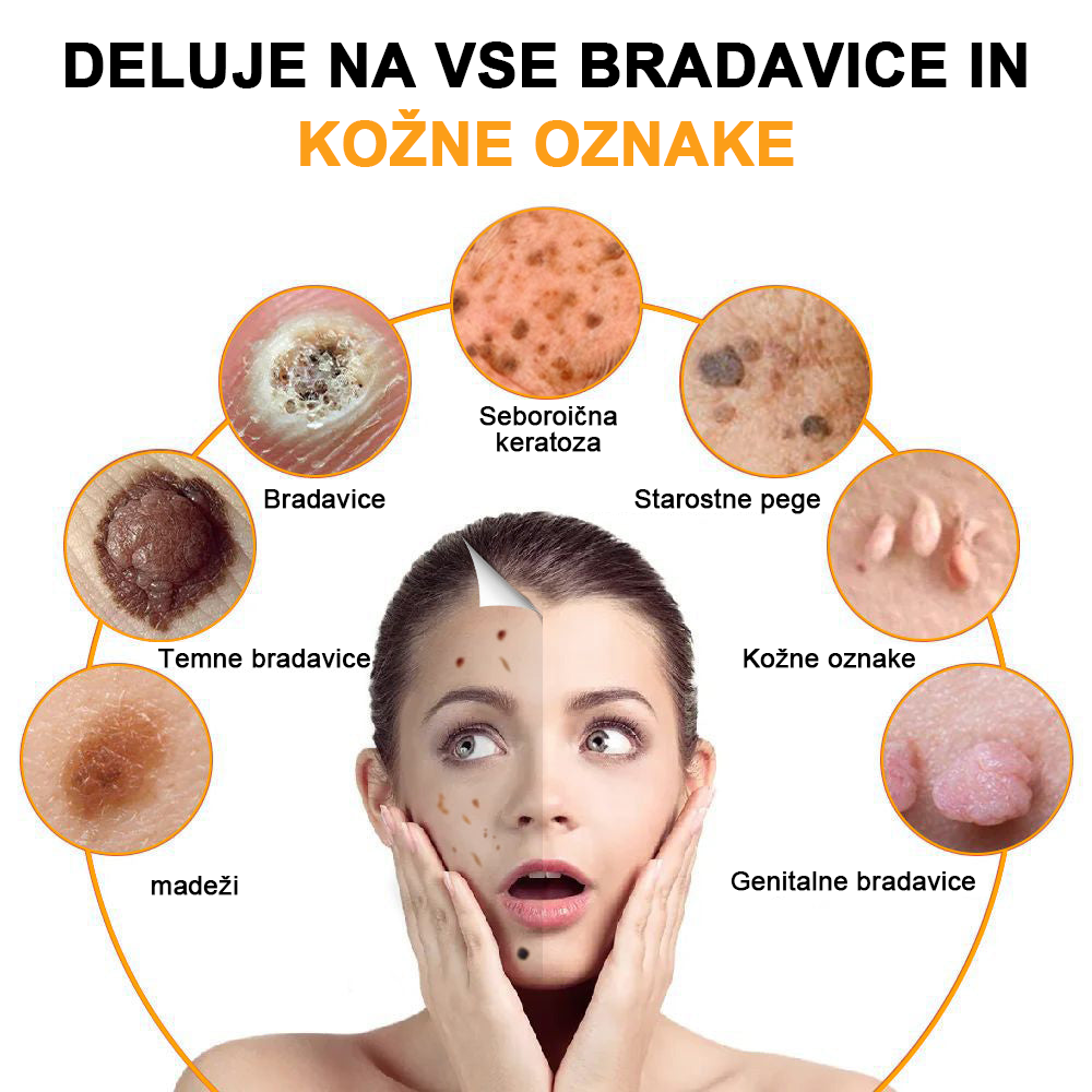 ✨🎁𝑭𝑹𝑶𝑷𝑼𝑵™ krema za odstranjevanje znamenj in madežev (85% popust zadnji dan dogodka)