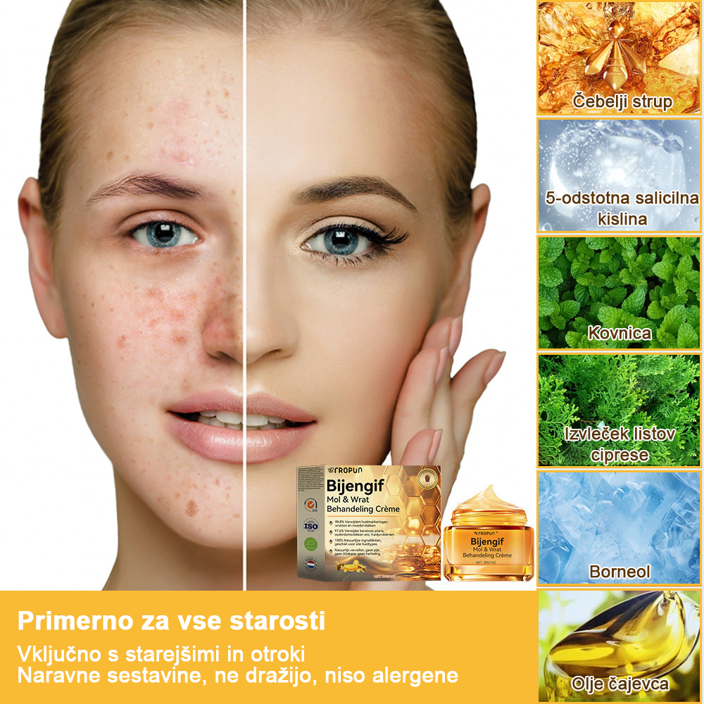 ✨🎁𝑭𝑹𝑶𝑷𝑼𝑵™ krema za odstranjevanje znamenj in madežev (85% popust zadnji dan dogodka)
