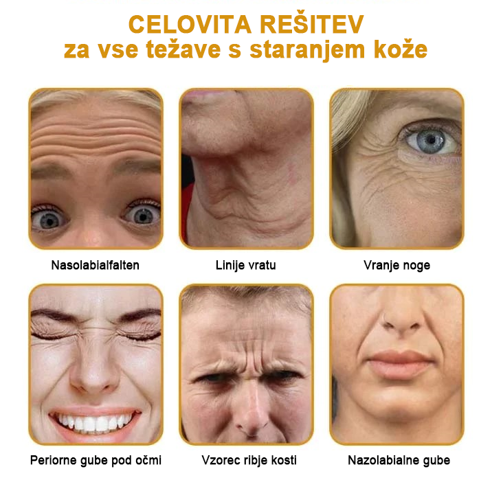 🍀 Zadnji dan promocije: 83 % popust ✨𝐅𝐮𝐫𝐳𝐞𝐫𝐨™ Kremni odstranjevalec gub z čebeljim strupom in botoks učinkom🐝