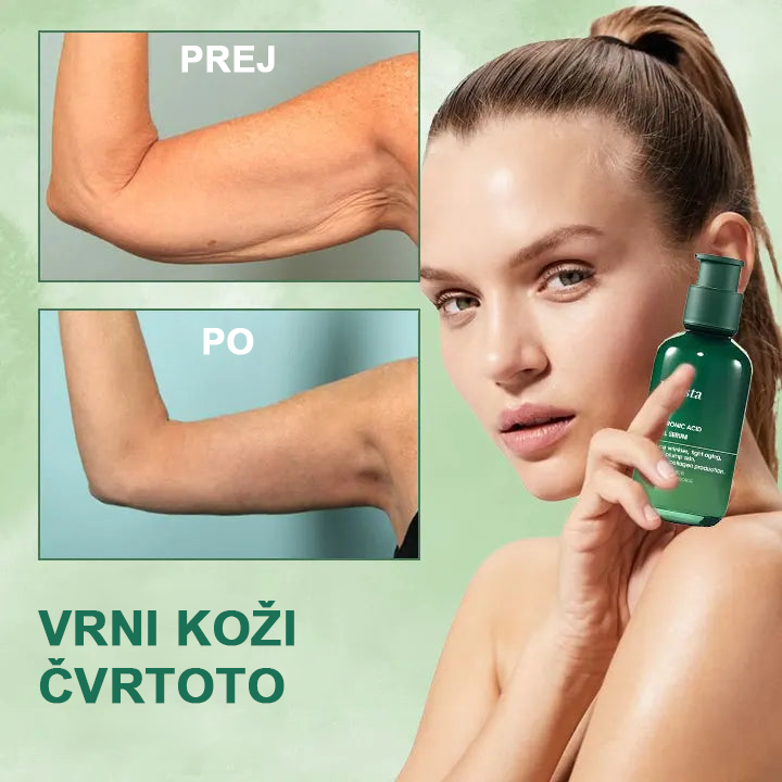 🌿Osvežite kožo v samo treh dneh💝𝙁𝙪𝙗𝙨𝙩𝙖™ pomlajevalni in učvrstitveni serum🔥