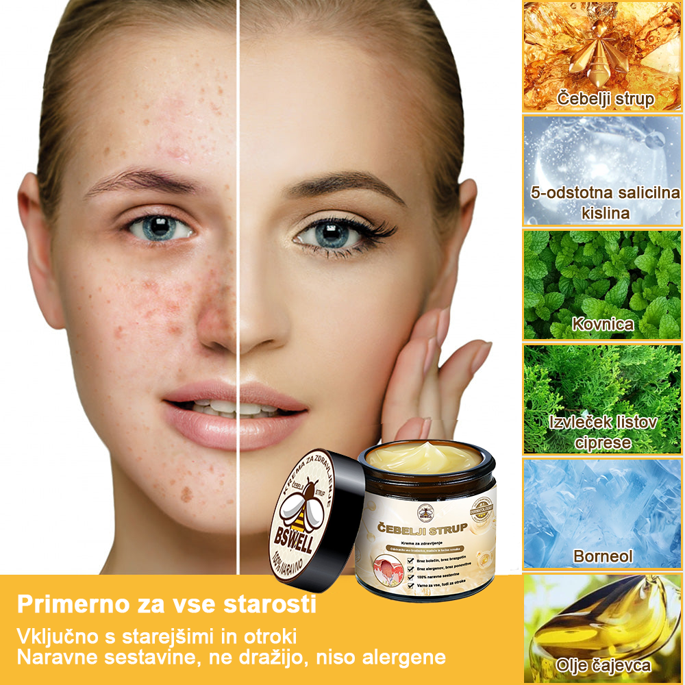 🐝✨𝑩𝑺𝑾𝑬𝑳𝑳® Krema za nego kože z čebeljim strupom👨⚕️ (Priporočena s strani AAD) (🔥 Zadnji dan promocije, prihranite 70%)