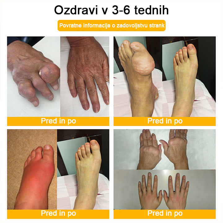 👩⚕️👩⚕️𝐀ее𝐡𝐟𝐧𝐠™ Krema s čebeljim strupom za napredno terapijo sklepov in kosti (izvleček novozelandske čebele - specializirano za ortopedske in artritisne bolečine)
