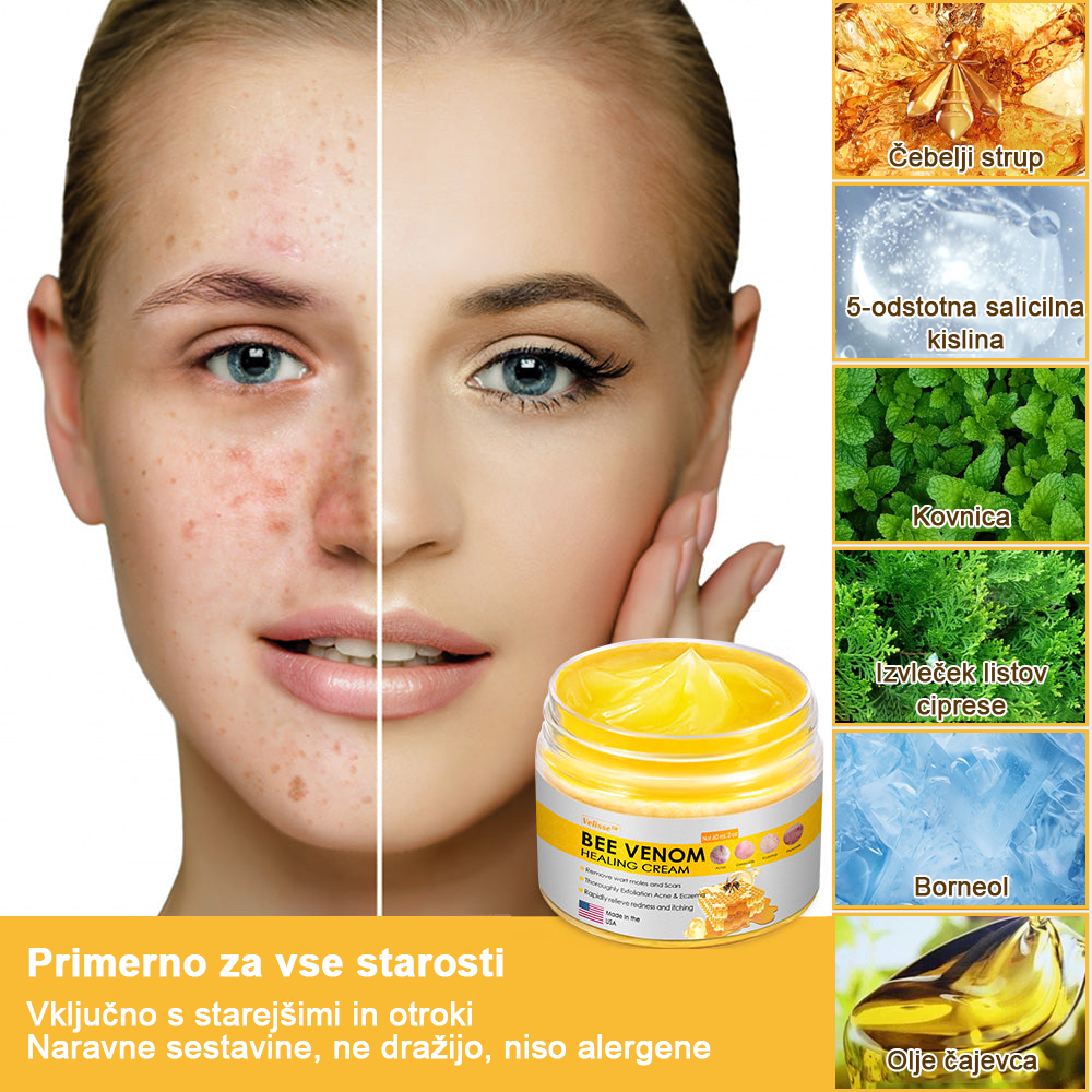 𝑽𝒆𝒍𝒊𝒔𝒔𝒆™ 2024 (priporoča AAD), za odstranjevanje bradavic, aken in brazgotin. Zdravi različne kožne bolezni