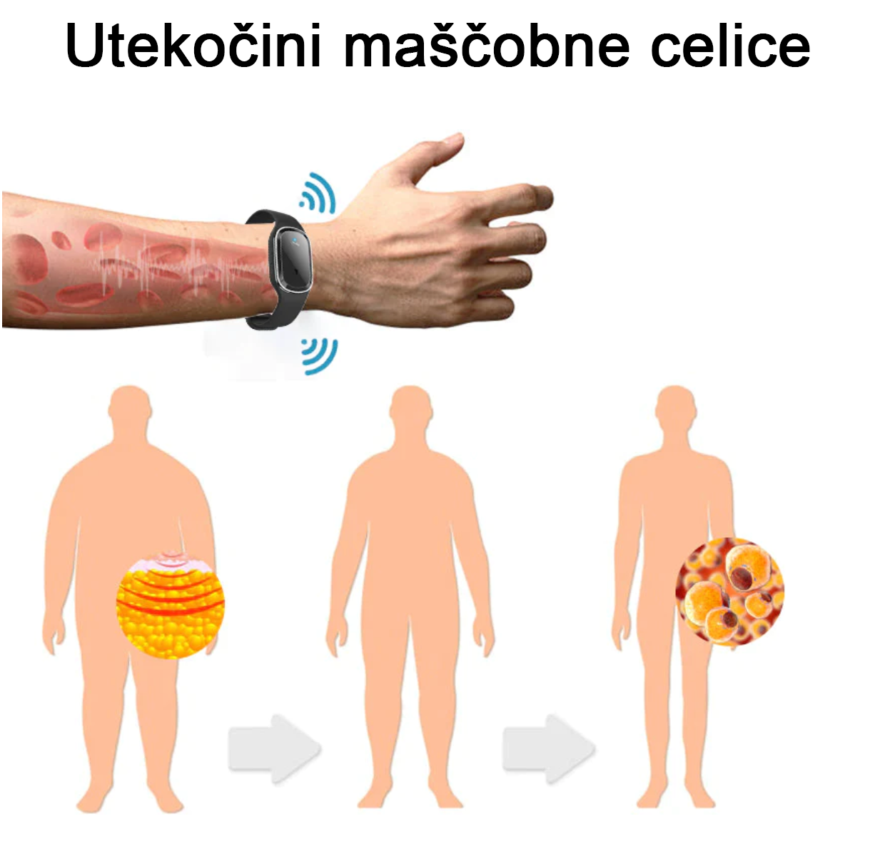 👨⚕️𝙂𝙁𝙊𝙐𝙆™Ultrazvočna zapestnica za odstranjevanje maščob in razstrupljanje (🔥 ZADNJI DAN 70% CENEJE)