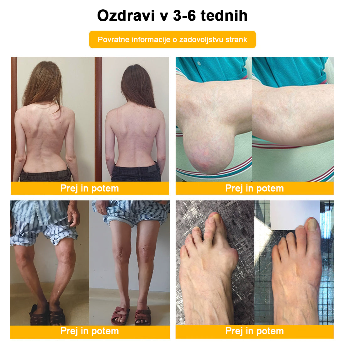 💎𝑭𝑨𝑻𝑶𝑵𝑮® Krema za lajšanje bolečin na osnovi čebeljega strupa, ki lajša bolečine v kosteh (posebej za starejše in priporoča AAOS)🌈