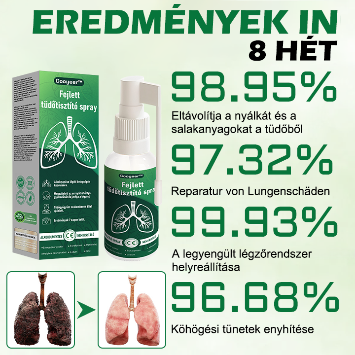🍀 𝐆𝐨𝐨𝐲𝐞𝐞𝐫™ napreden sprej za čiščenje pljuč – podpira zdravje pljuč, bronhijev in nosnih votlin, spodbuja zdravje dihalnega sistema in lažje dihanje.