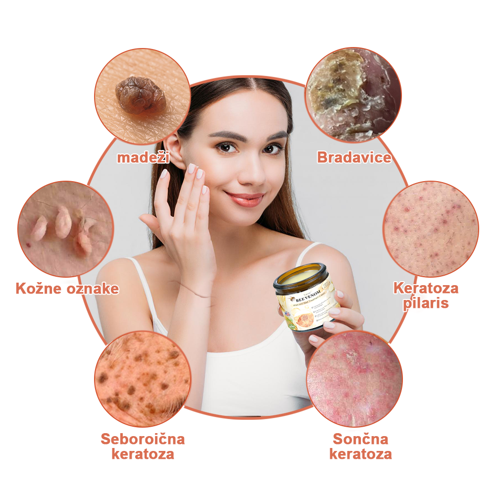 🍊𝑻𝒖𝒓𝒐𝒏𝒖™ Zdravilno mazilo s čebeljim strupom (👨⚕𝐀𝐀𝐃 PRIPOROČILA)
