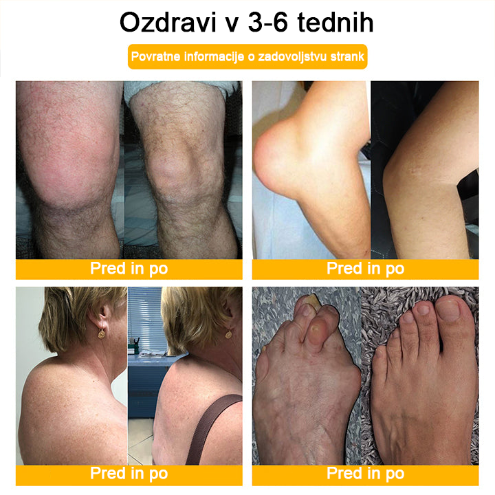👩⚕️👩⚕️𝐀ее𝐡𝐟𝐧𝐠™ Krema s čebeljim strupom za napredno terapijo sklepov in kosti (izvleček novozelandske čebele - specializirano za ortopedske in artritisne bolečine)