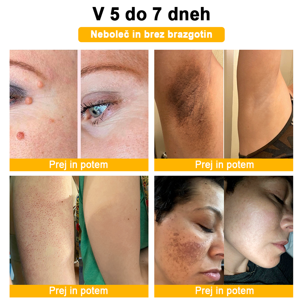 🐝✨𝑩𝑺𝑾𝑬𝑳𝑳® Krema za nego kože z čebeljim strupom👨⚕️ (Priporočena s strani AAD) (🔥 Zadnji dan promocije, prihranite 70%)