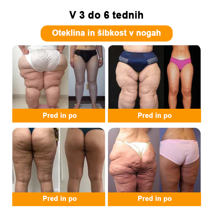 𝐀𝐞𝐞𝐡𝐟𝐞𝐧𝐠™ 𝐙𝐞𝐥𝐢šč𝐧𝐞 𝐫𝐚𝐳𝐬𝐭𝐫𝐮𝐩𝐥𝐣𝐞𝐯𝐚𝐥𝐧𝐞 𝐤𝐫𝐨𝐠𝐥𝐢𝐜𝐞 𝐳𝐚 𝐯𝐞𝐧𝐞 𝐳𝐚 𝐤𝐨𝐩𝐞𝐥 𝐧𝐨𝐠🦵👩⚕️ (LANA Certification, European Lymphology Association)