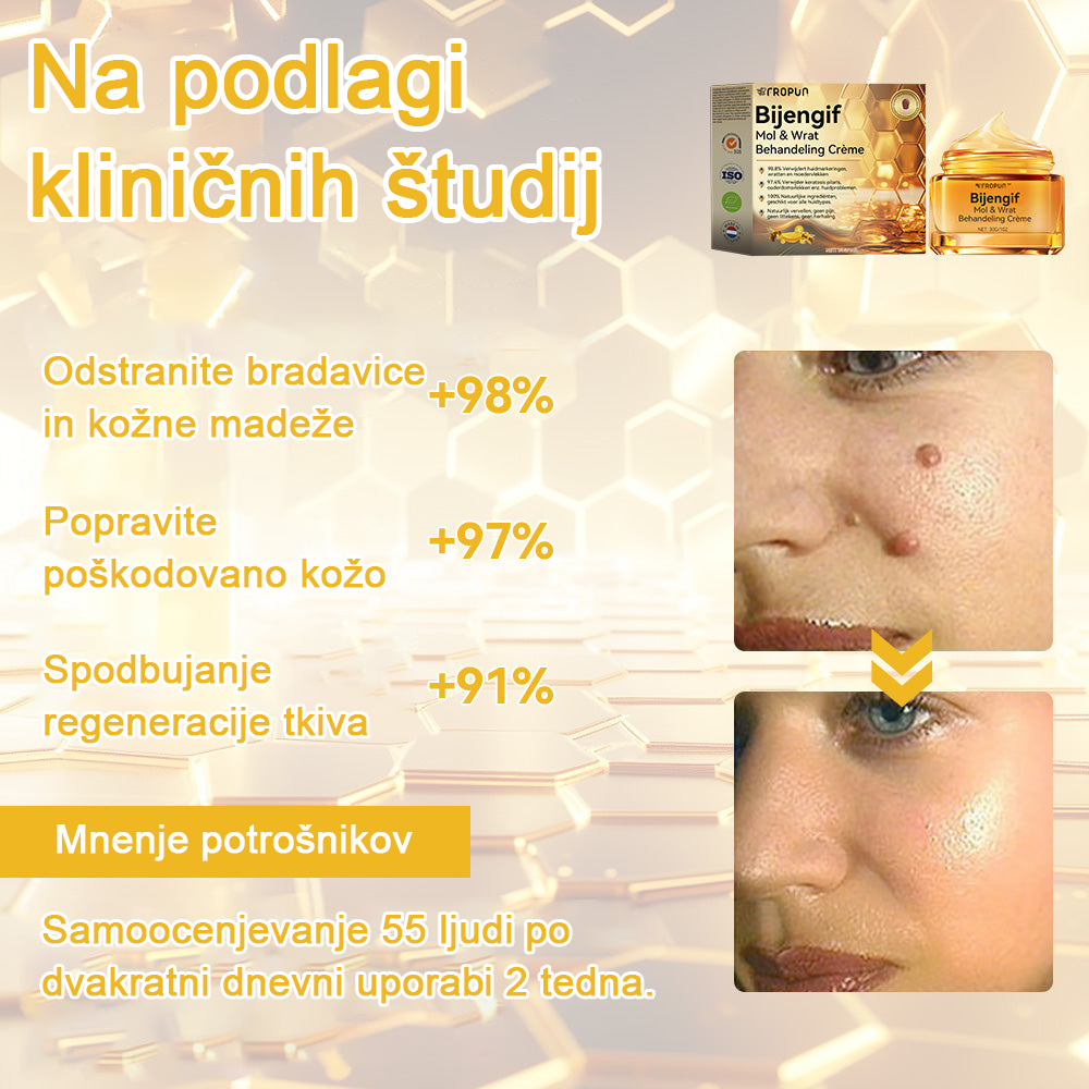 ✨🎁𝑭𝑹𝑶𝑷𝑼𝑵™ krema za odstranjevanje znamenj in madežev (85% popust zadnji dan dogodka)