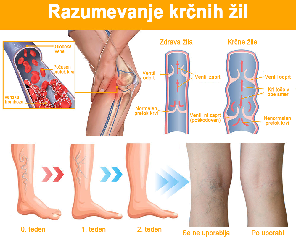 【✨Plačilo po povzetju✨】𝙁𝙪𝙧𝙯𝙚𝙧𝙤™ Pršilo za krčne žile s čebeljim strupom 🐝