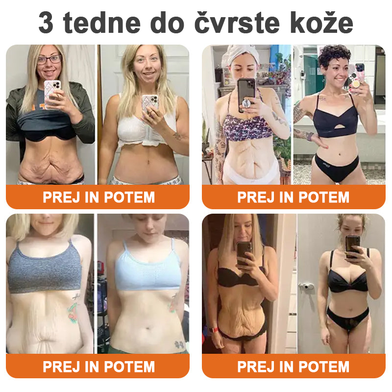 ✨Flysmus™ Botox Čebelji Strup Firming Stick🔥ZADNJI DAN 70 % CENEJE