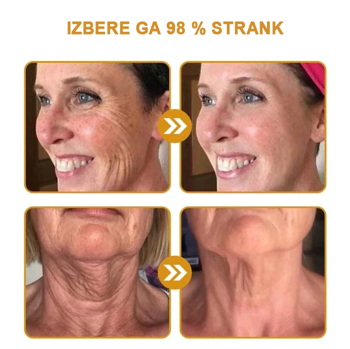 🍀 Zadnji dan promocije: 83 % popust ✨𝐅𝐮𝐫𝐳𝐞𝐫𝐨™ Kremni odstranjevalec gub z čebeljim strupom in botoks učinkom🐝