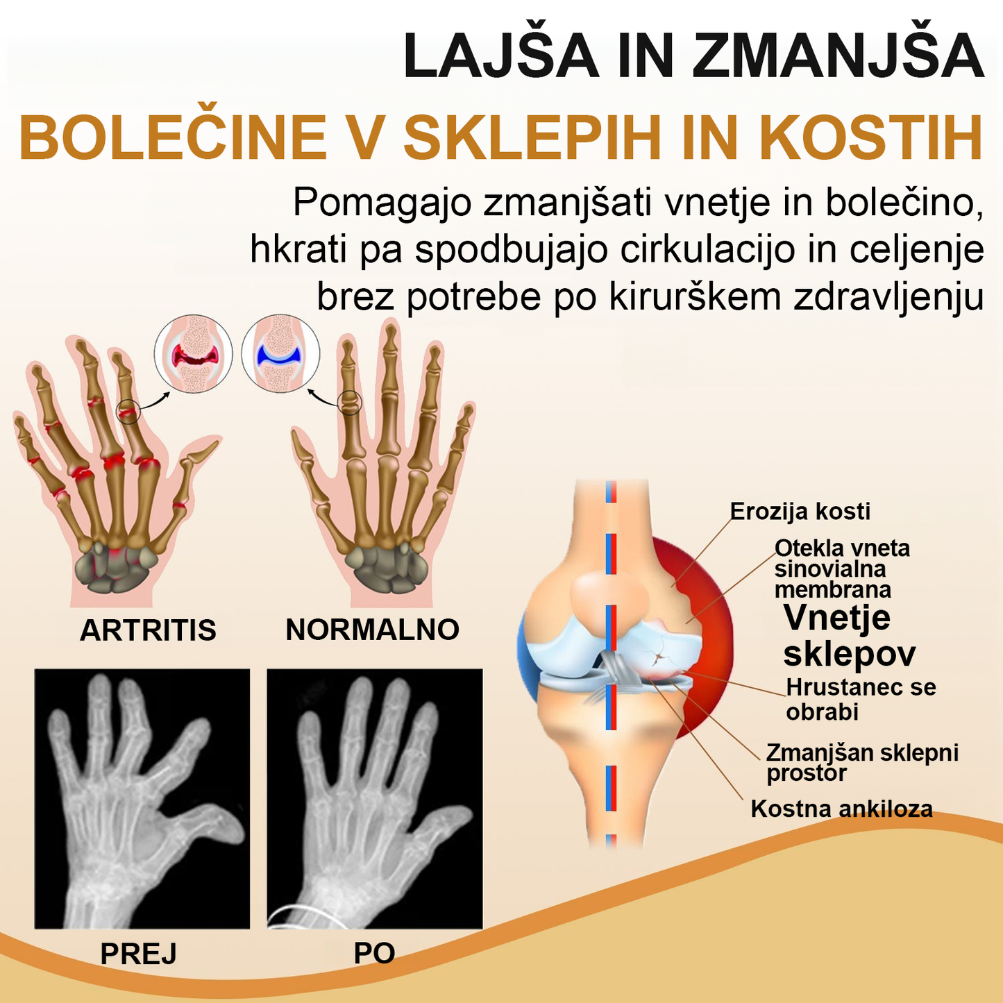 🌿TODAHOF™ Sprej za sklepe s čebeljim strupom💎Primeren za vse starosti🔥 Časovno omejen 75% popust