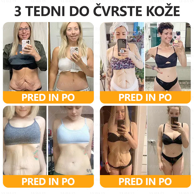 ✨ VLSVLS® krema za obnovo kože s čebeljim strupom 🔥 ZADNJI DAN 80% CENEJE